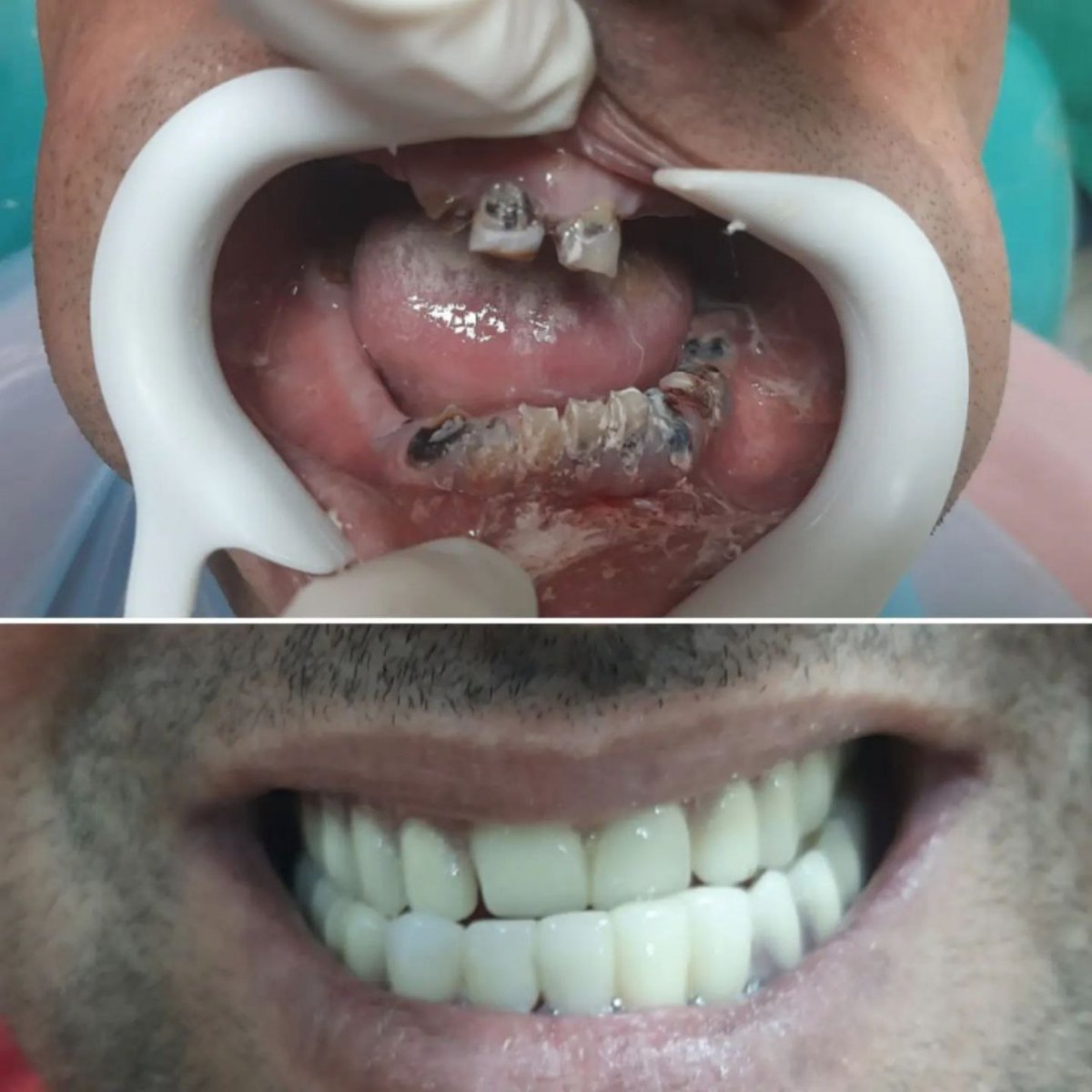 نمونه کار دندان 2