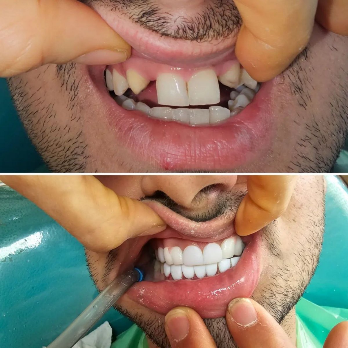 نمونه کار دندان 3